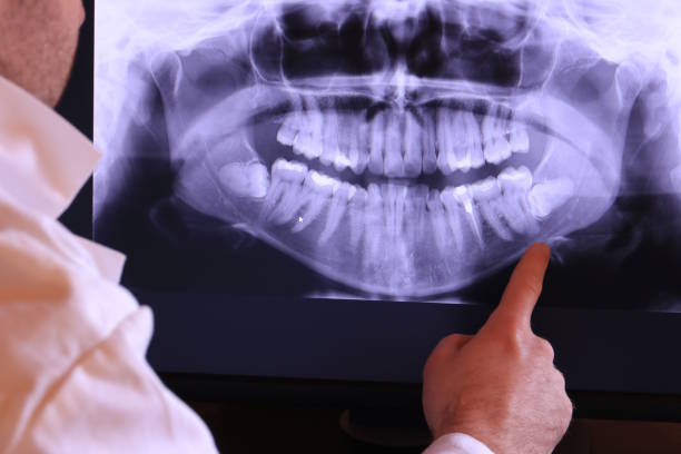 Best Emergency Dental Filling Replacement  in Sheffield, IA