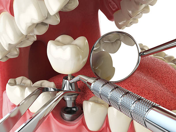 Best Knocked-Out Tooth Emergency  in Sheffield, IA